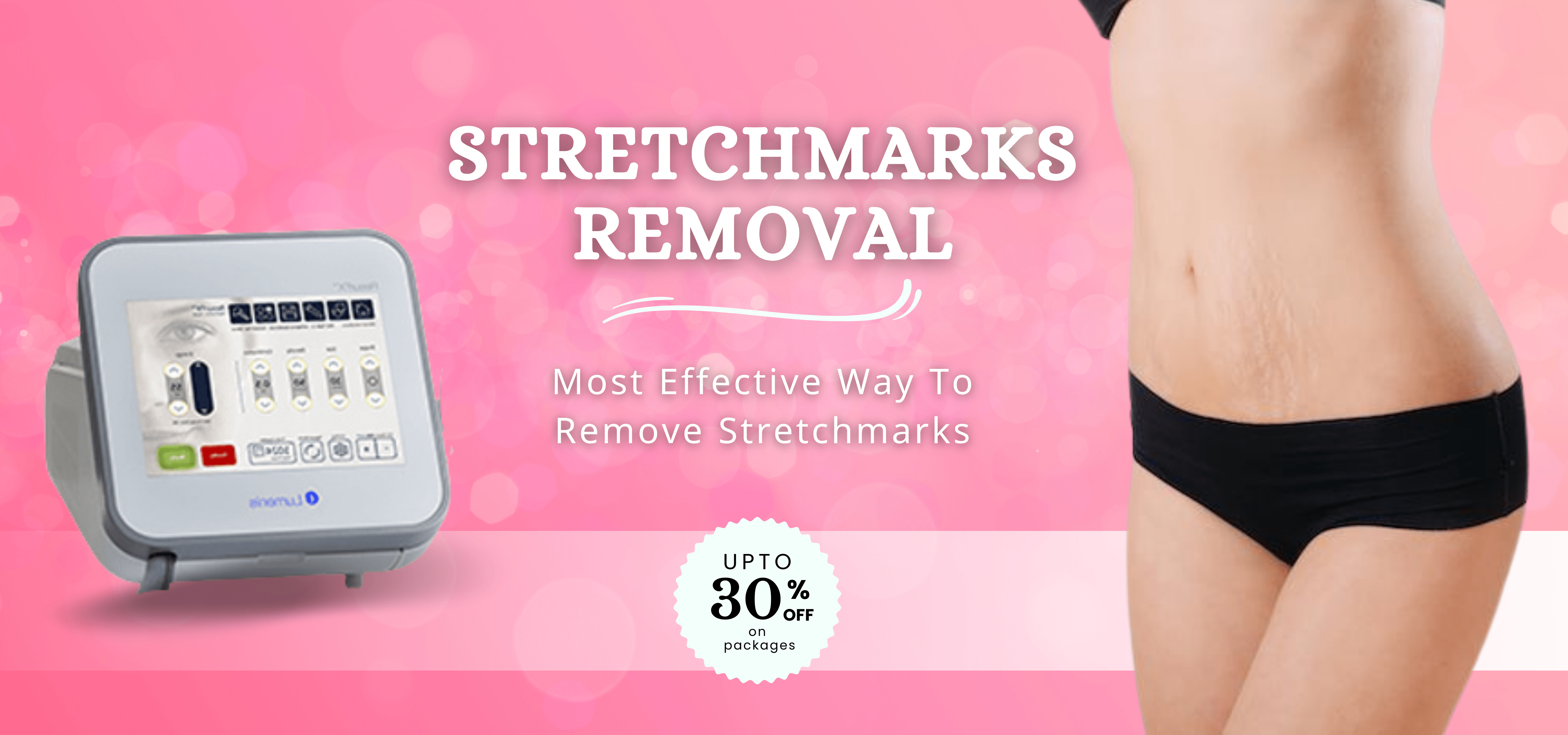 Stretchmarks